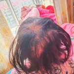 Con gái 3 tuổi rụng gần hết tóc, mẹ đưa đến bệnh viện, bác sĩ nói “Hãy báo cảnh sát”